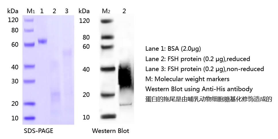 FSH抗原的SDS-PAGE和WB分析图